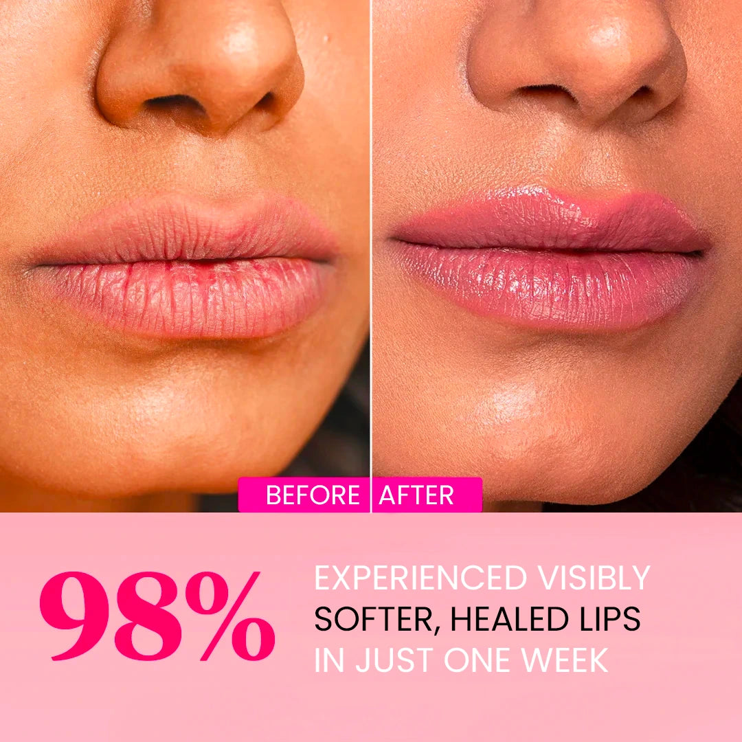 Plumping Lip Masks - Hydrolyzed Collagen, Hyaluronic Acid, Centella Asiatica
