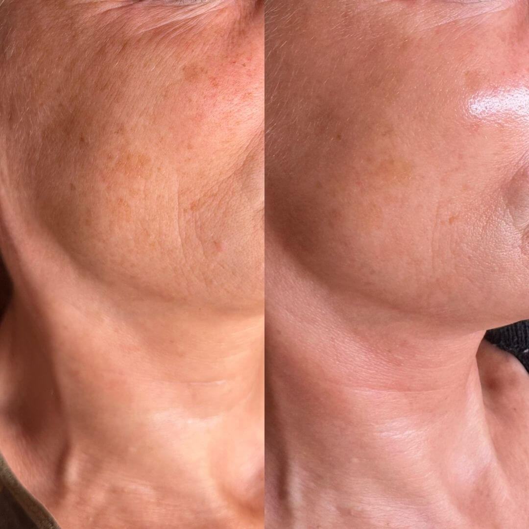 Elixir Serum - 24kGold Ceramides Niacinamide Vitamin C