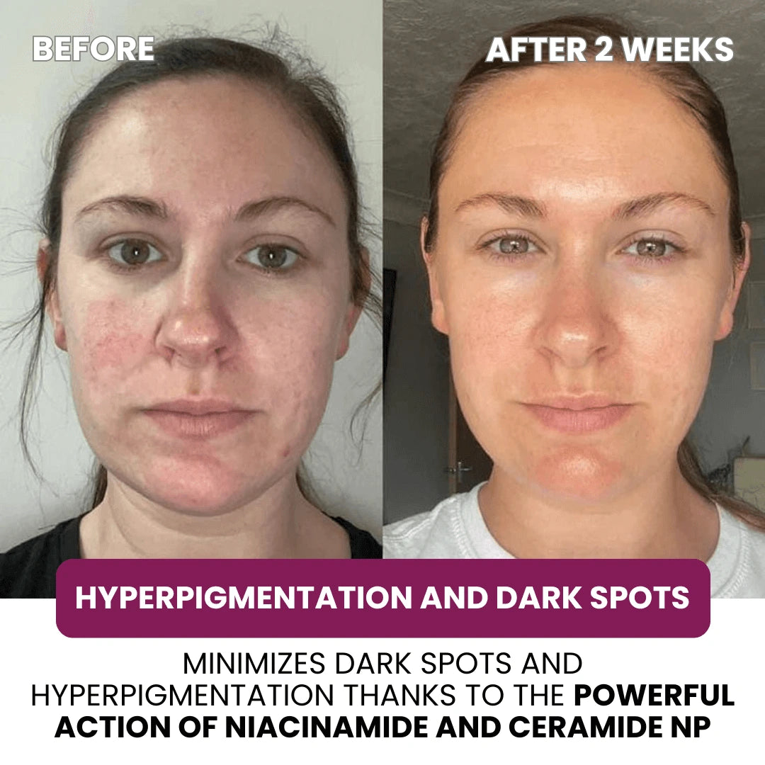Regenerating Mask with Hydrolyzed Collagen and Niacinamide
