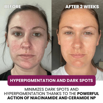 Regenerating Mask with Hydrolyzed Collagen and Niacinamide