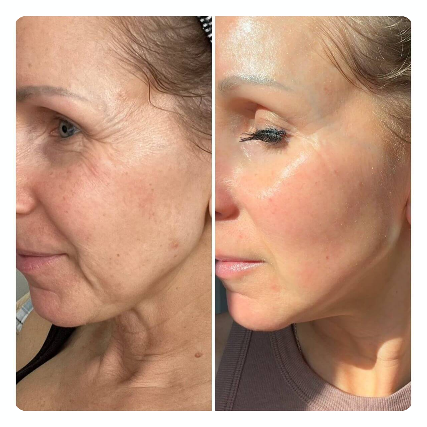 Regenerating Mask with Hydrolyzed Collagen and Niacinamide
