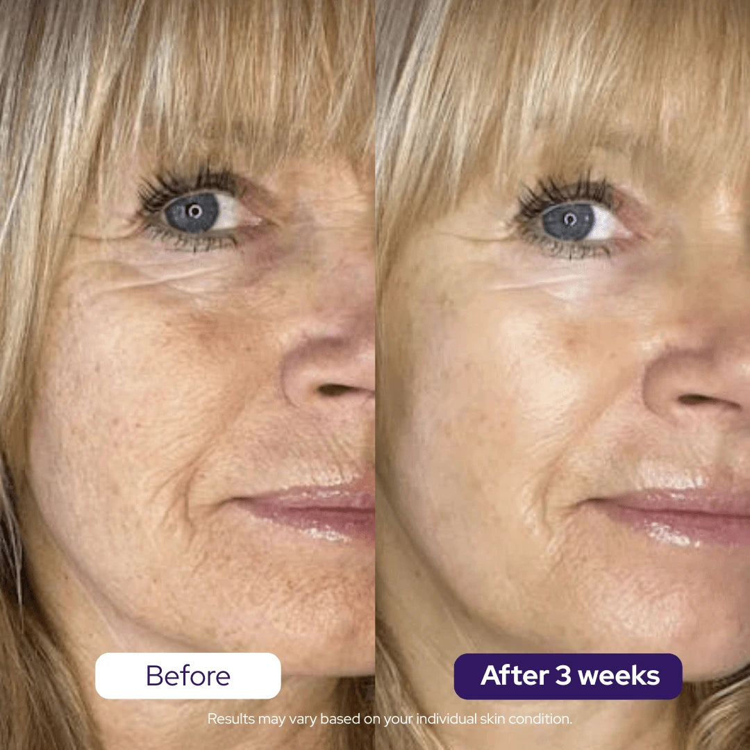 BUY 1 + GET 1 FREE Hydrolyzed Collagen Age Defying Mask