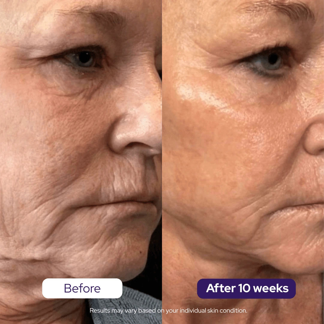 BUY 1 + GET 1 FREE Hydrolyzed Collagen Age Defying Mask