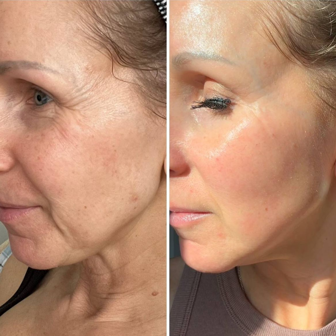 Regenerating Mask with Hydrolyzed Collagen and Niacinamide