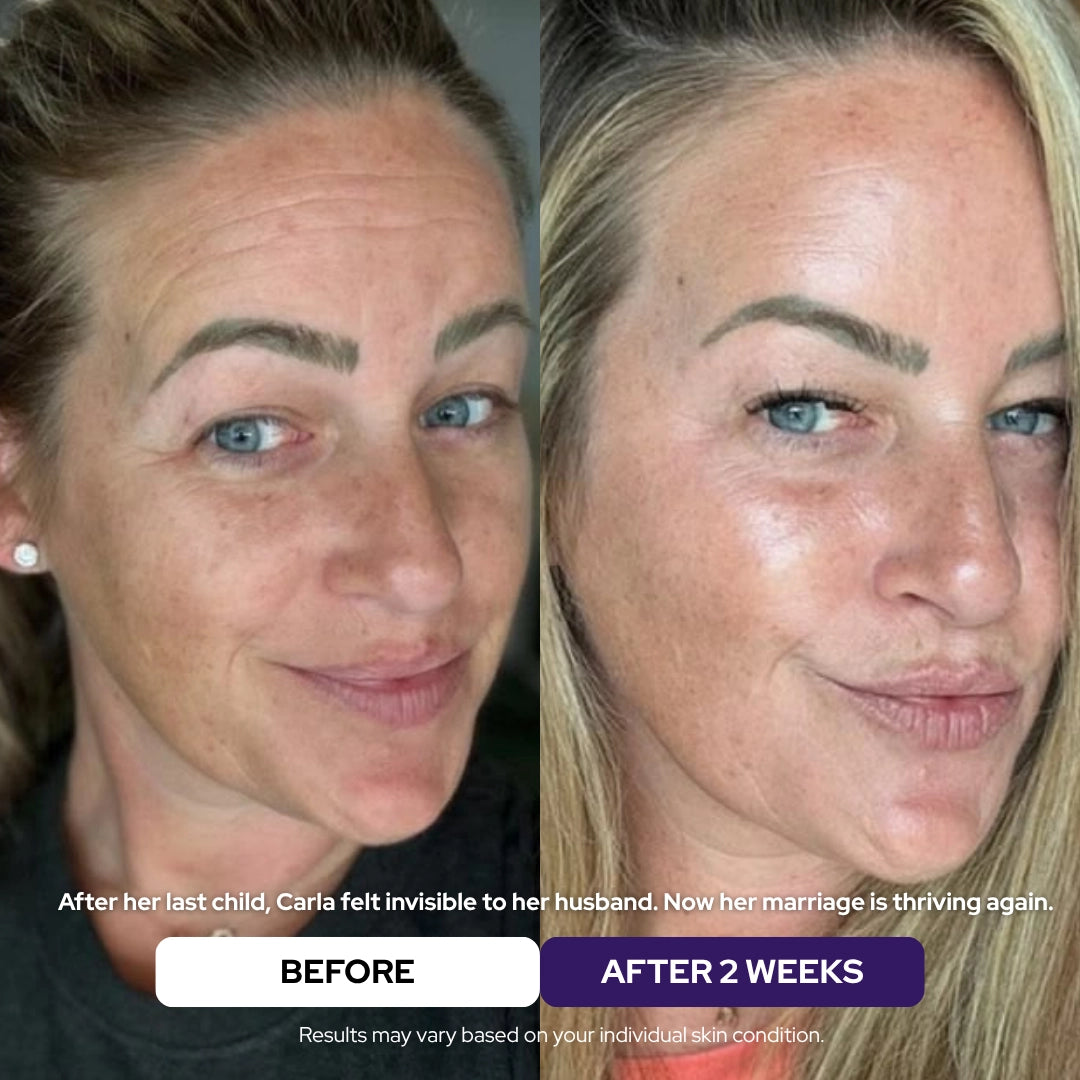 BUY 1 + GET 1 FREE Hydrolyzed Collagen Age Defying Mask