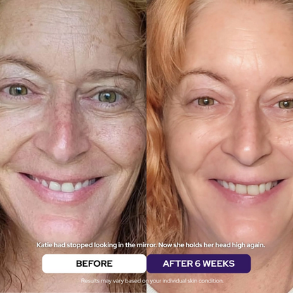 BUY 1 + GET 1 FREE Hydrolyzed Collagen Age Defying Mask
