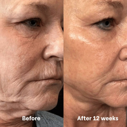 Regenerating Mask with Hydrolyzed Collagen and Niacinamide