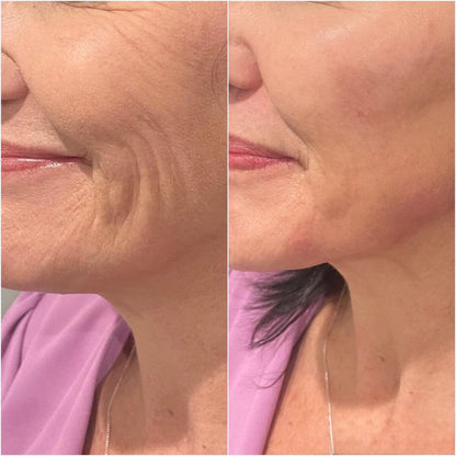 Regenerating Mask with Hydrolyzed Collagen and Niacinamide