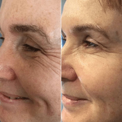 Regenerating Mask with Hydrolyzed Collagen and Niacinamide